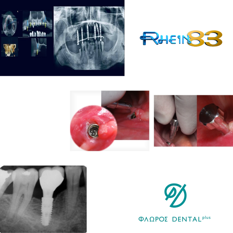 Floros Dental